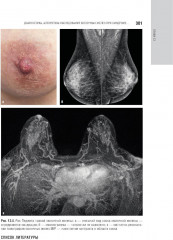 Маммология - Фото 2