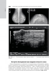 Маммология - Фото 3