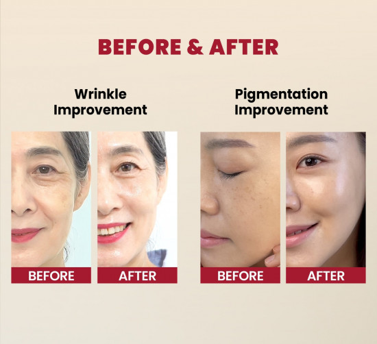 Сыворотка для лица с ретиналем антивозрастная «Retinal Liposome 2% + Black Ginseng»