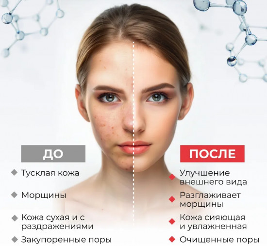 Пенка для лица с гликолевой и салициловой кислотой «Glycolite Max»