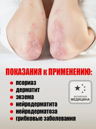 Лосьон от псориаза «Фуфан»