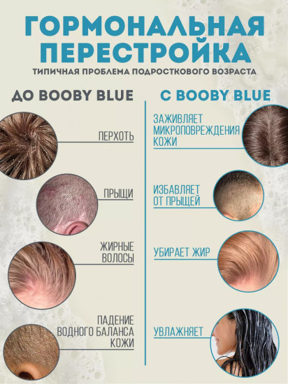 Гель для умывания с экстрактом гуавы и цинком