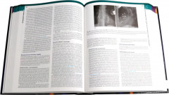 Болезни сердца по Браунвальду. Комплект из 3 книг - Фото 7