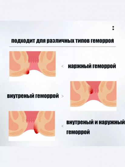 Мазь от геморроя «Хуа То Gucallo»