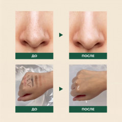 Гидрофильное масло с экстрактом сосновых иголок и пробиотиками «Pine Cica 1% + Probiotics» - Фото 3