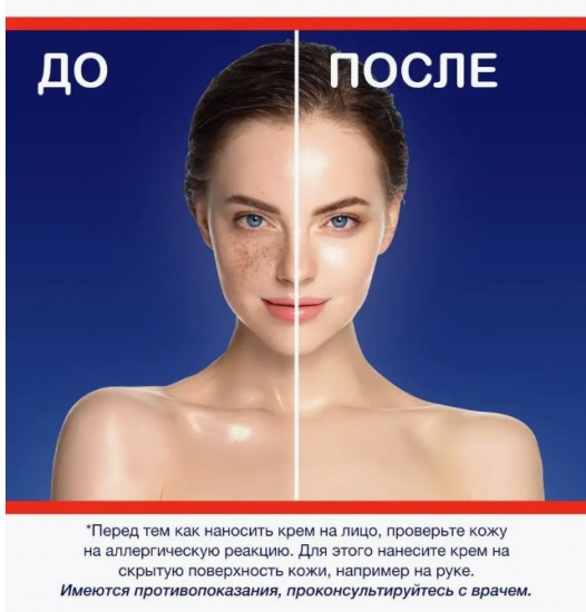 Отбеливающий крем для лица «Expigment 4%»