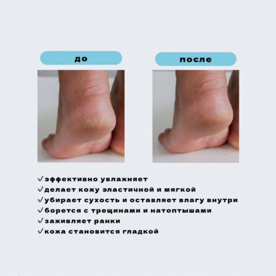 Лечебный спа-крем для ног от трещин с мочевиной «Healing Foot Spa Cream»