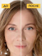 Патчи для кожи вокруг глаз «Tony&glow» - Фото 11