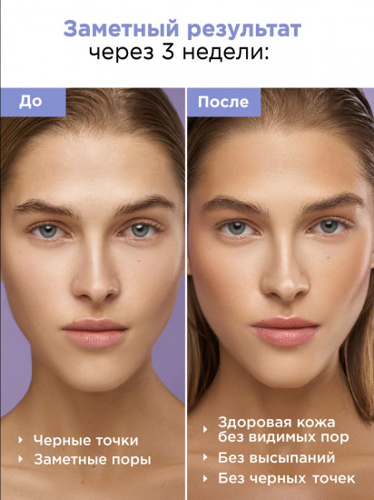 Гидрофильное масло для глубокого очищения кожи лица «Deep Cleansing Oil»