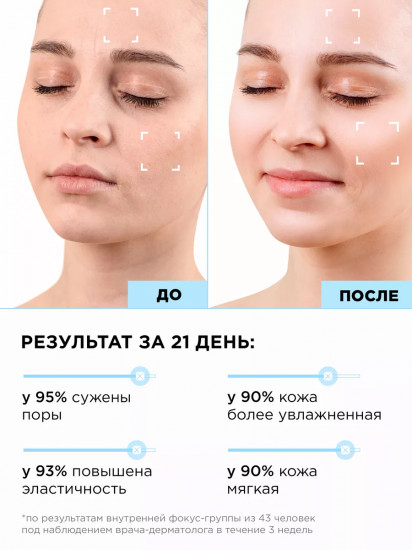 Крем-гель для жирной кожи с ниацинамидом и цинком «Hyaluron Matte Skin Cream»