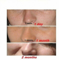 Крем отбеливающий для лица и тела «Ахроактив» - Фото 4