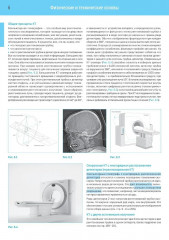 Компьютерная томография. Базовое руководство - Фото 2