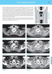 Компьютерная томография. Базовое руководство - Фото 4