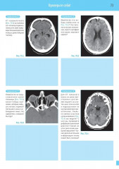 Компьютерная томография. Базовое руководство - Фото 5
