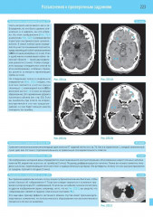 Компьютерная томография. Базовое руководство - Фото 6