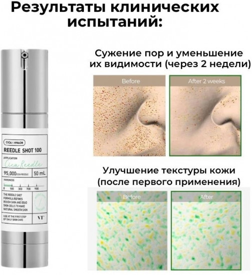 Сыворотка для лица «Reedle Shot 100»