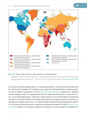 Латентная туберкулезная инфекция. Эпидемиология, патогенез, диагностика, лечение - Фото 4