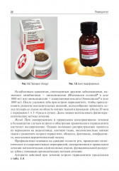 Одонтогенные воспалительные заболевания полости рта - Фото 7