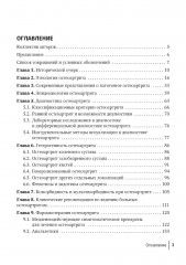 Остеоартрит - Фото 1