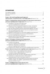 Детский церебральный паралич - Фото 1