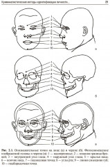 Судебно-медицинская идентификация личности по стоматологическому статусу - Фото 5