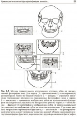 Судебно-медицинская идентификация личности по стоматологическому статусу - Фото 7