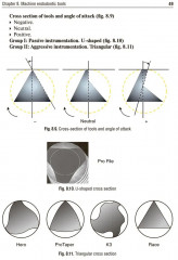 Preclinical course of dentistry. Part 3. Endodontology - Фото 8