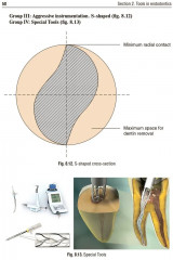 Preclinical course of dentistry. Part 3. Endodontology - Фото 9
