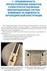 Имплантология. Ключевые моменты - Фото 3