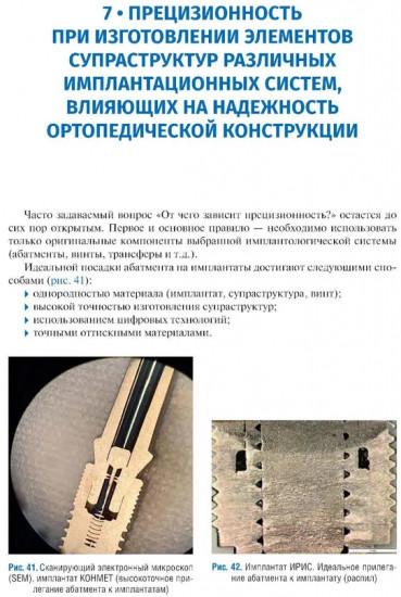 Имплантология. Ключевые моменты