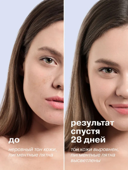 Крем для лица и тела осветляющий от пигментных пятен