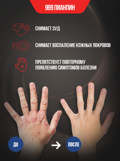 Мазь от экземы и дерматитов «999 Пианпин»