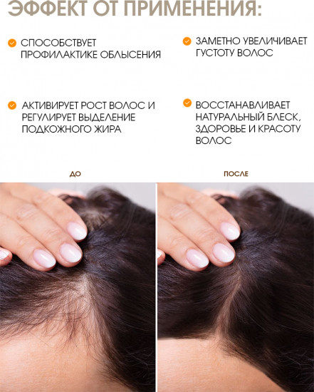 Шампунь от облысения «Natural»