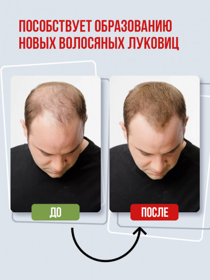Шампунь от облысения с луком