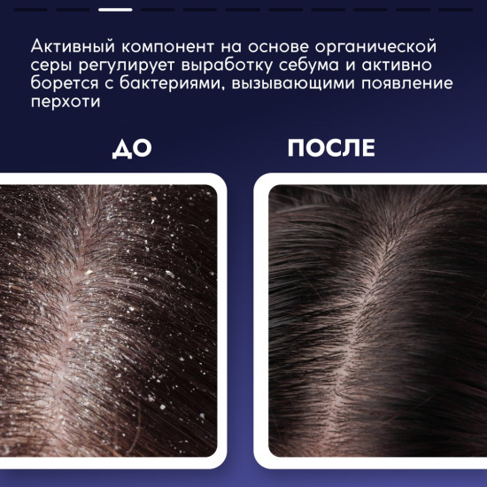 Пилинг для очищения кожи головы от перхоти отшелушивающий