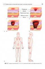 Помощник по уходу: учебное пособие - Фото 13