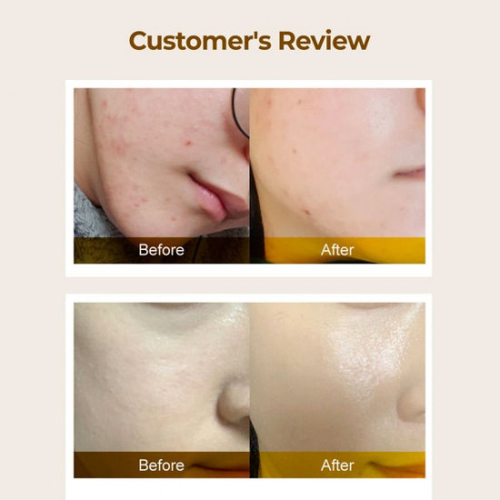 Тонер-эссенция для лица выравнивающий «Super Glowing Essence Toner №3»