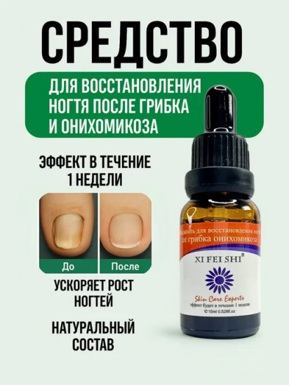 Средство от грибка ногтей «Онихомикоза»