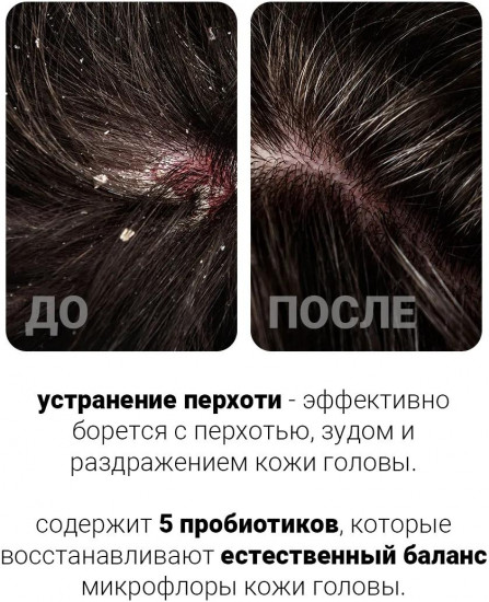 Шампунь для волос с пробиотиками глубокоочищающий «5 Probiotics Scalp Scaling Shampoo»
