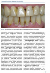 Профессиональная и индивидуальная гигиена полости рта у взрослых - Фото 3
