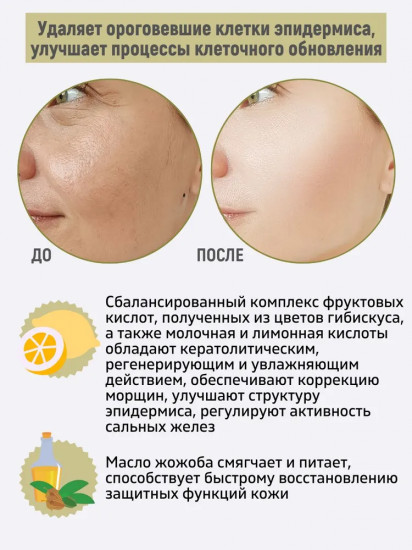 Паста-биопилинг для лица с АНА кислотами гибискуса