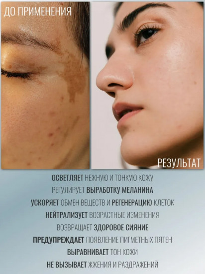 Крем экстраотбеливающий «Tranexamic»