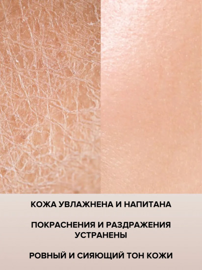 Крем для очень сухой кожи лица SPF 25