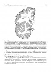 Private neurology. Частная неврология - Фото 14