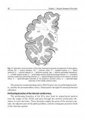 Private neurology. Частная неврология - Фото 15