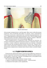 Оперативная дентистрия - Фото 7