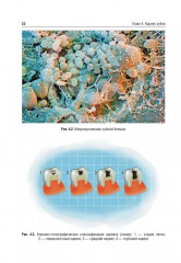 Оперативная дентистрия - Фото 8