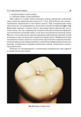 Оперативная дентистрия - Фото 9