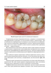 Оперативная дентистрия - Фото 13