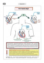 Имплантируемые кардиовертеры-дефибрилляторы. Иллюстрированное пошаговое руководство - Фото 8